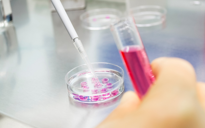 hku bachelor of engineering in biomedical engineering